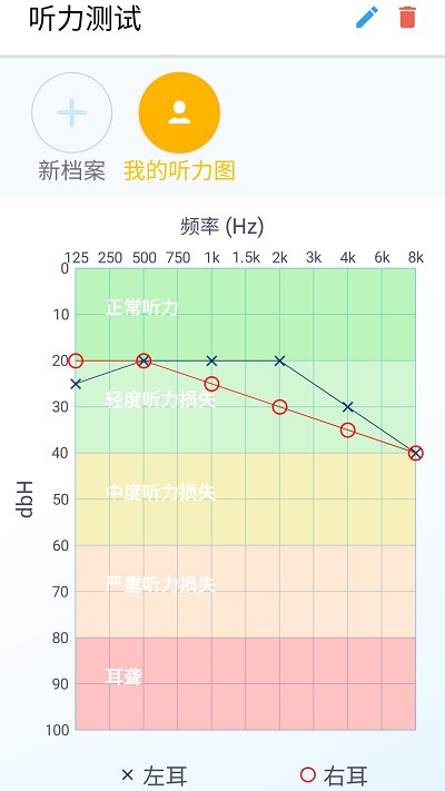 艾米助听app